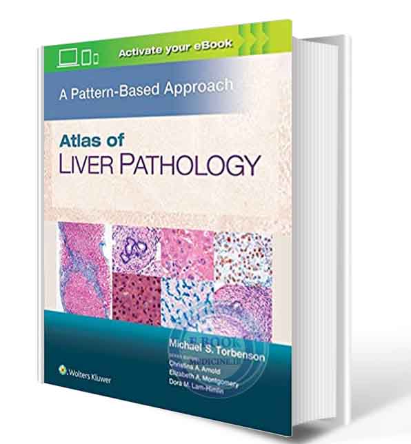 دانلود کتابAtlas of Liver Pathology: A Pattern-Based Approach 1st 2018 (  PDF)